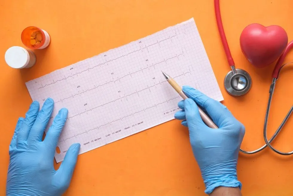 Healthcare professional analyzing an electrocardiogram