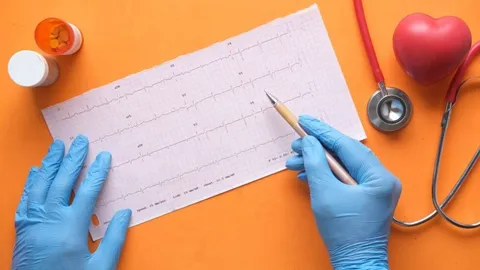 Gesundheitsfachkraft analysiert ein Elektrokardiogramm